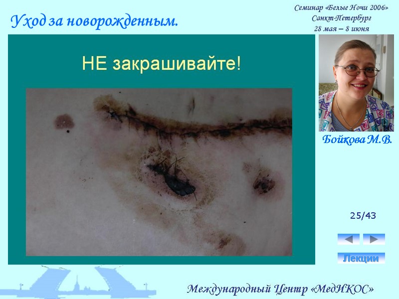 25/43 Лекции Уход за новорожденным. Бойкова М.В.